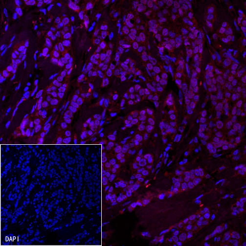 Androgen Receptor Recombinant Rabbit Mab Alexa Fluor Conjugate