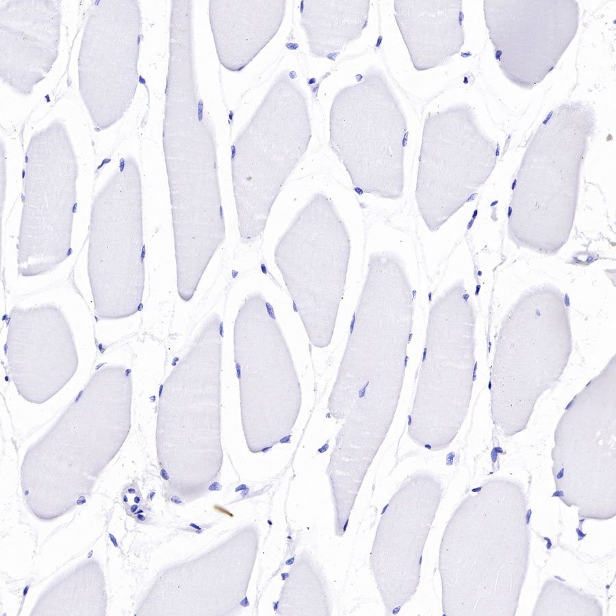 S RMabB7 H3 CD276 Recombinant Rabbit MAb SDT R158 Q5ZPR3 Starter Bio