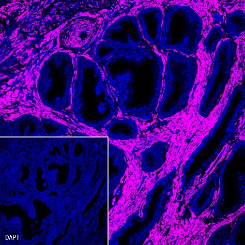 Alexa Fluor® 647 Antibody Labeling Kit