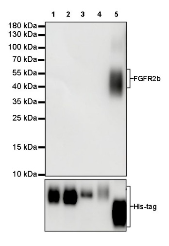 FGFR2b Recombinant Rabbit mAb (SDT-423-2)