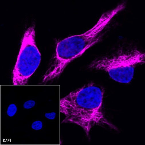 Alexa Fluor® 647 Antibody Labeling Kit