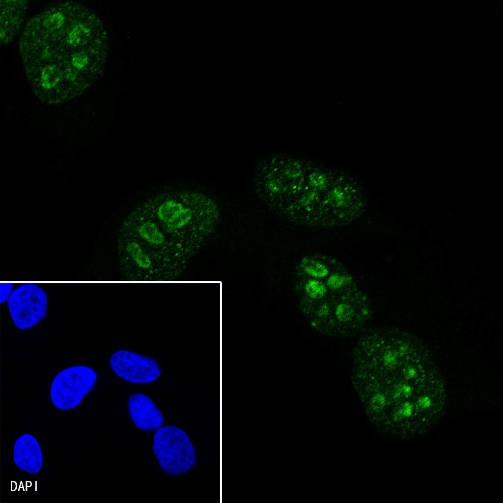 Ki67 Recombinant Mouse mAb,PBS Only (SDT-606-7)