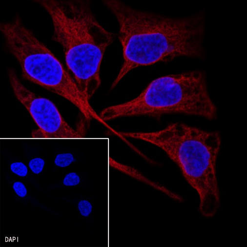 Goat anti-Rabbit IgG(H+L) (Alexa Fluor® 594 Conjugate)