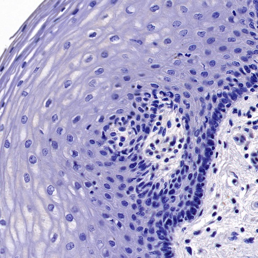 p16 Recombinant Rabbit mAb (SDT-303-206)