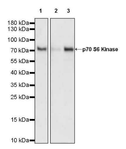 p70 S6 Kinase Recombinant Rabbit mAb (S-1278-2)