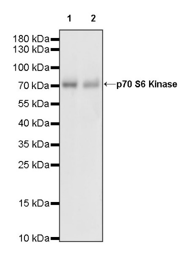 p70 S6 Kinase Recombinant Rabbit mAb (S-1278-2)