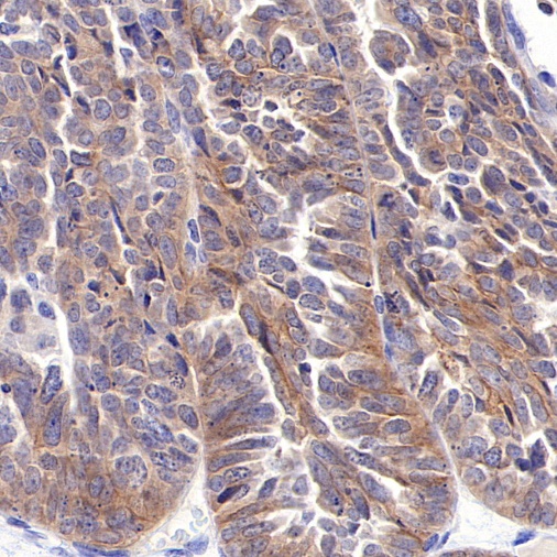 ROR1 Recombinant Rabbit mAb ,PBS Only (SDT-R501-147)