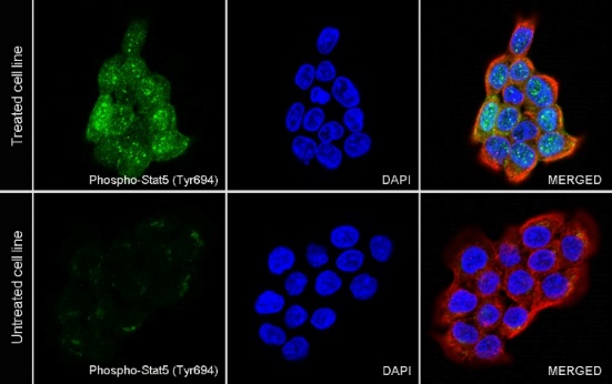 Phospho-Stat5 (Tyr694) Recombinant Rabbit mAb (S-1183-58)