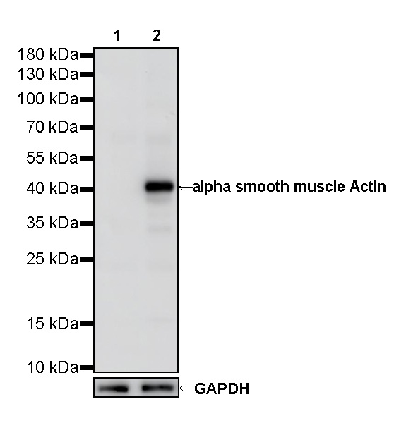 alpha smooth muscle Actin Recombinant Mouse mAb (SDT-R142)