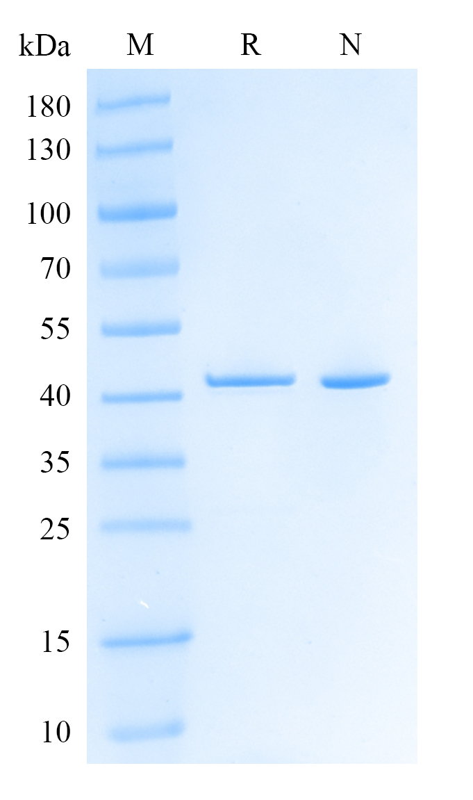 HRSV(Strain A2)Nucleoprotein,His Tag  Protein