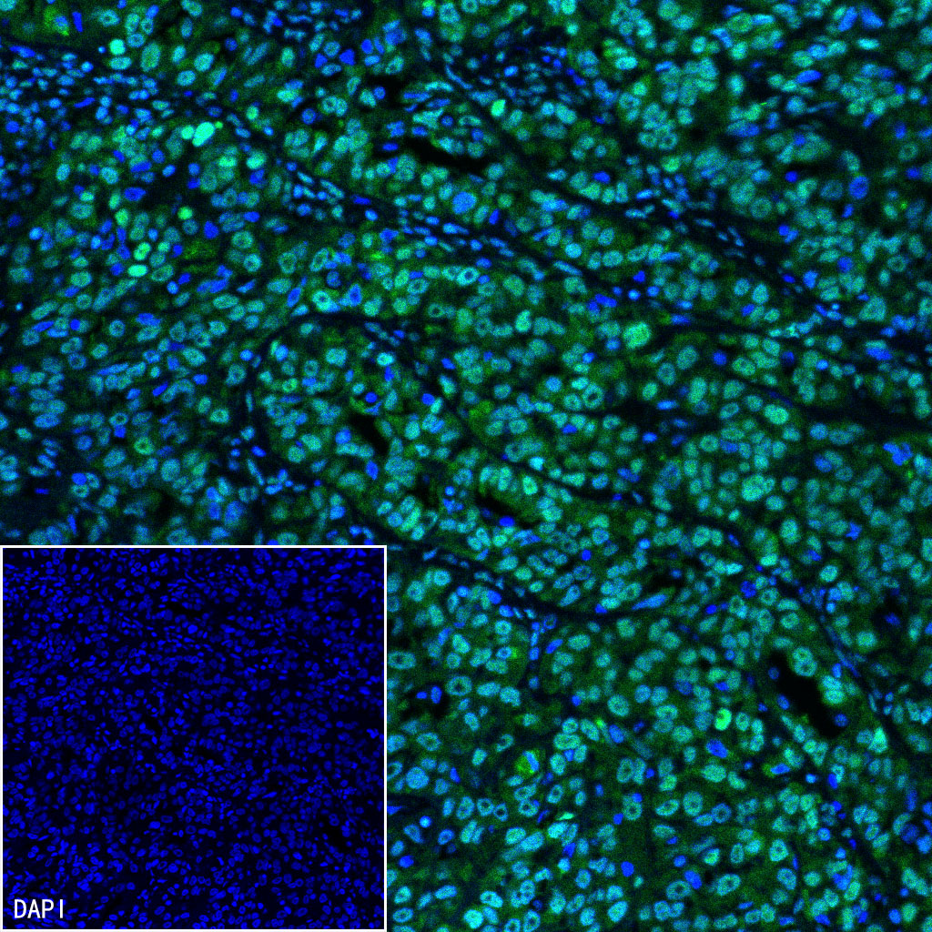 FUBP1 Recombinant Rabbit mAb (SDT-R060)