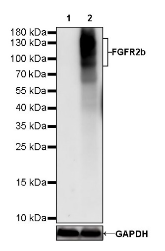 FGFR2b Recombinant Rabbit mAb (SDT-423-2)