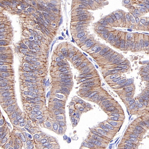 ROR1 Recombinant Rabbit mAb ,PBS Only (SDT-R501-147)