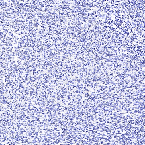 ROR1 Recombinant Rabbit mAb ,PBS Only (SDT-R501-147)