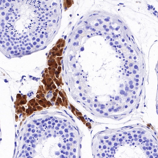 STAT5 Recombinant Rabbit mAb (S-R234)