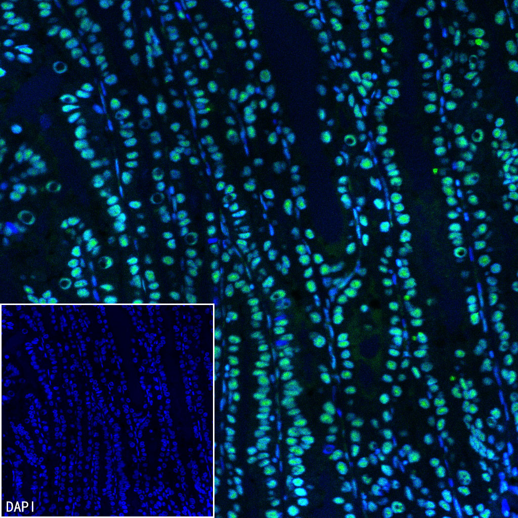 FUBP1 Recombinant Rabbit mAb (SDT-R060)