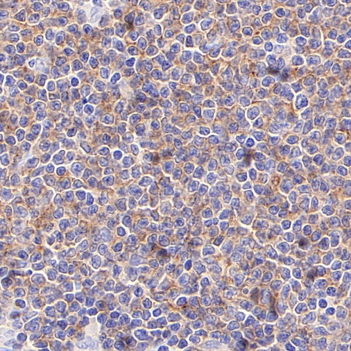 ROR1 Recombinant Rabbit mAb (SDT-R501-147)