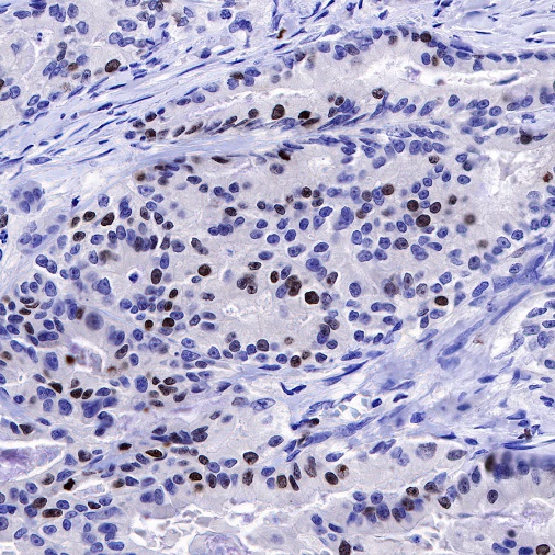 Ki67 Recombinant Mouse mAb (SDT-606-7)