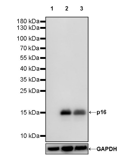 p16 Recombinant Rabbit mAb (SDT-303-206)