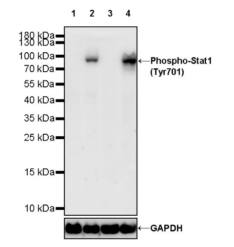 Phospho-Stat1 (Tyr701) Recombinant Rabbit mAb (S-601-78)