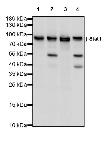 Stat1 Recombinant Rabbit mAb (S-559-91)