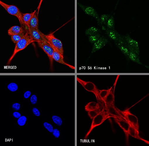 p70 S6 Kinase Recombinant Rabbit mAb (S-1278-2)