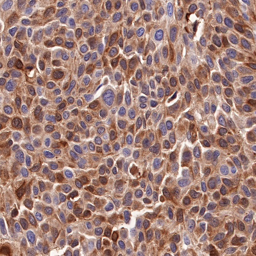 STAT5 Recombinant Rabbit mAb (S-R234)