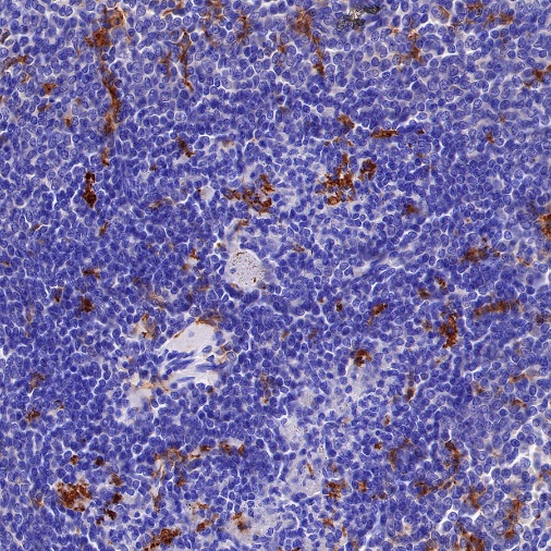 CD11c Recombinant Rabbit mAb (SDT-396-48)