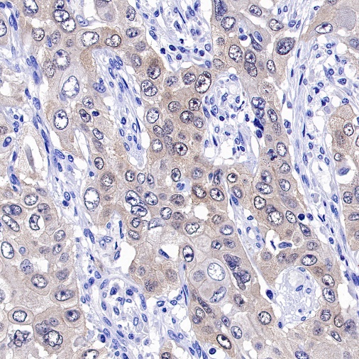 p16 Recombinant Rabbit mAb (SDT-303-206)