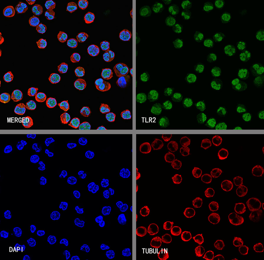 GST-π Recombinant Rabbit mAb,PBS Only (SDT-R054)