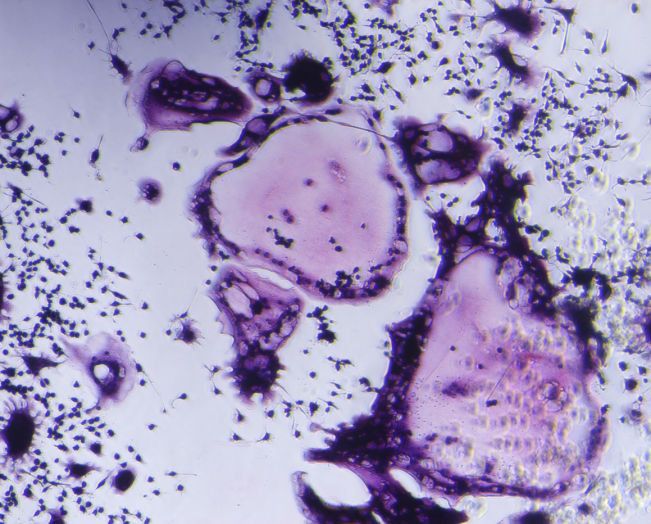 item.picture[0].fileOrgName