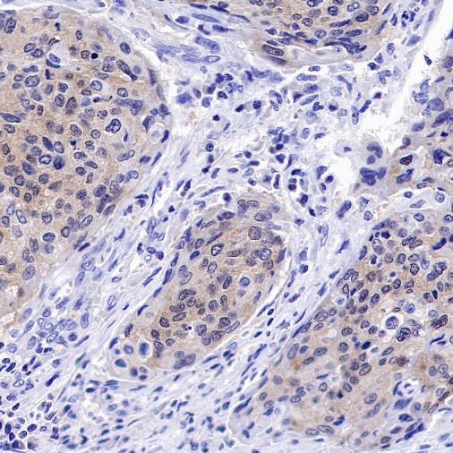 p16 Recombinant Rabbit mAb (SDT-303-206)