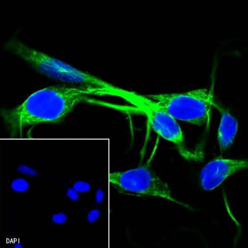 β-tubulin Recombinant Rabbit mAb (SDT-312-113)