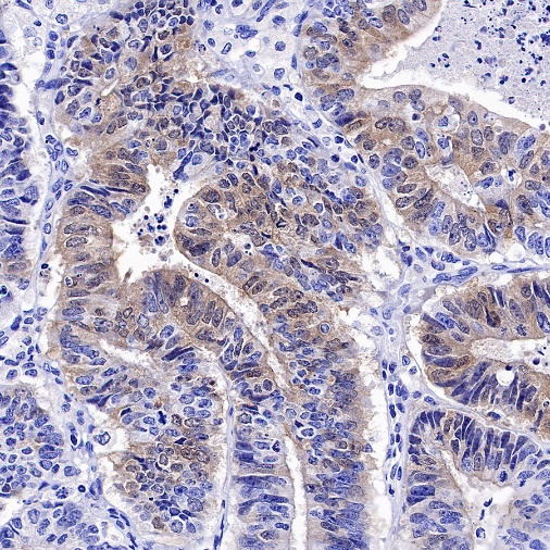 p16 Recombinant Rabbit mAb (SDT-303-206)