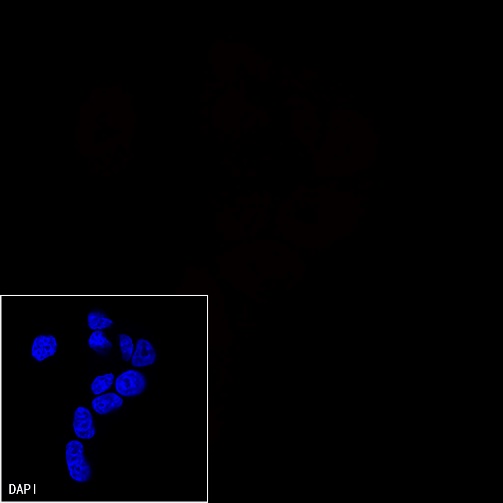 p16 Recombinant Rabbit mAb (Alexa Fluor® 555 Conjugate) (SDT-303-206)