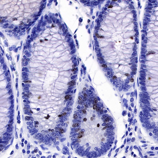 Ki67 Recombinant Mouse mAb,PBS Only (SDT-606-7)