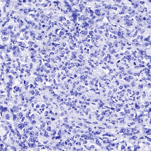 FGFR2b Recombinant Rabbit mAb (SDT-423-2)