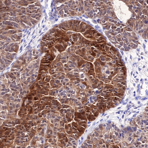 STAT5 Recombinant Rabbit mAb (S-R234)