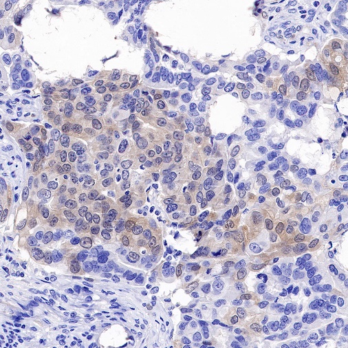 p16 Recombinant Rabbit mAb (SDT-303-206)