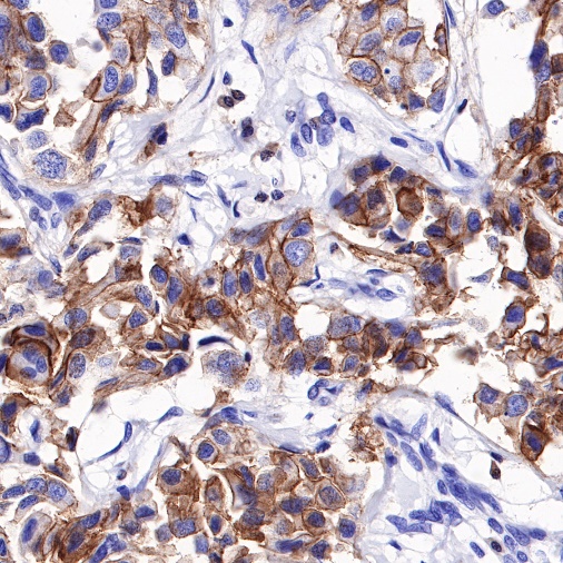 STAT5 Recombinant Rabbit mAb (S-R234)