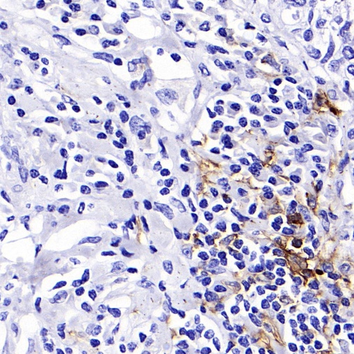 CD11c Recombinant Rabbit mAb (SDT-396-48)