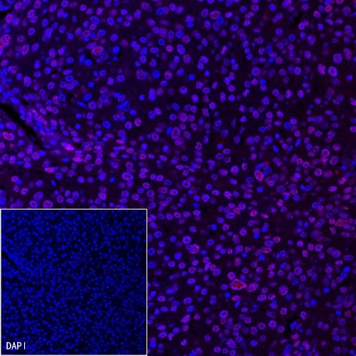 p16 Recombinant Rabbit mAb (Alexa Fluor® 555 Conjugate) (SDT-303-206)