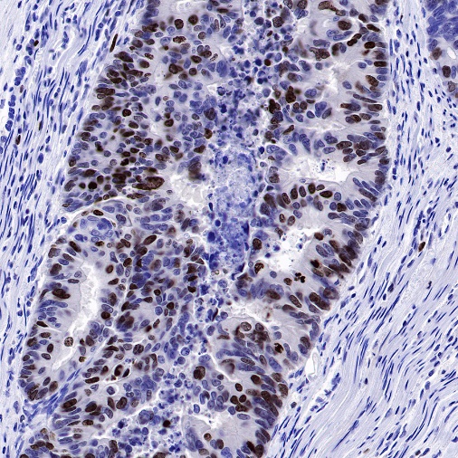 Ki67 Recombinant Mouse mAb,PBS Only (SDT-606-7)