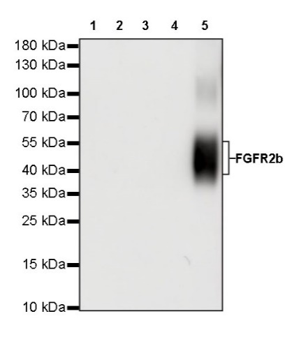 FGFR2b Recombinant Rabbit mAb,PBS Only (SDT-423-18)