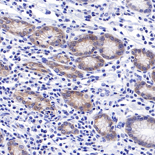 ROR1 Recombinant Rabbit mAb (SDT-R501-147)