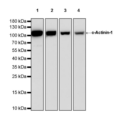 Rabbit anti-α-Actinin-1 Recombinant Monoclonal Antibody(HRP Conjugate)(311-20)