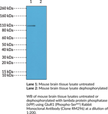 GluR1 (Phospho-Ser845) Rabbit Monoclonal Antibody (Clone RM296)