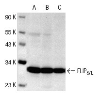 FLIPS/L (G-11)