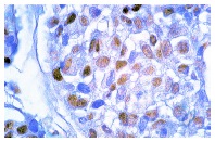 p70 S6 kinase α (H-9)