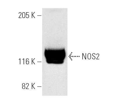 NOS2 (C-11)